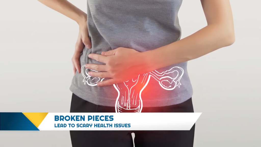 Paragard IUD Injuries