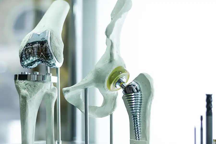 A display case showcasing knee implants, providing a close-up view of the intricate design and craftsmanship.