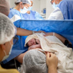 Common Types of Birth Injuries During Labor and Delivery